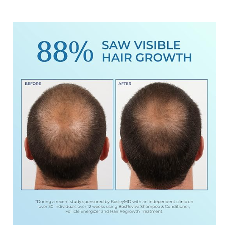 BOSLEY TRATAMIENTO DE RECRECIMIENTO DEL CABELLO MASCULINO EN SPRAY